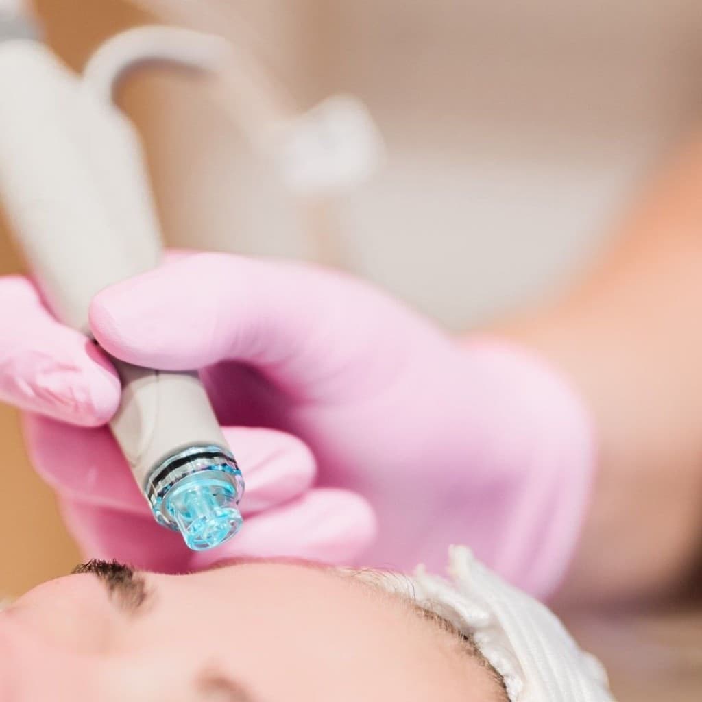 Microneedling a Rabat : solution pour les cicatrices d'acne ?